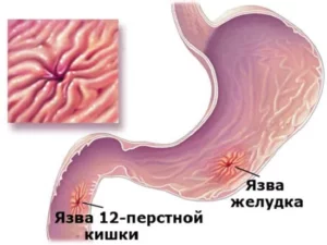 Язвенная болезнь желудка Язвенная болезнь желудка у кошек и собак